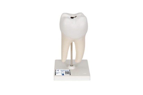 model ludzkiego dolnego trzonowca z ubytkami - 1000243 [d10/4] 3b scientific modele anatomiczne 2